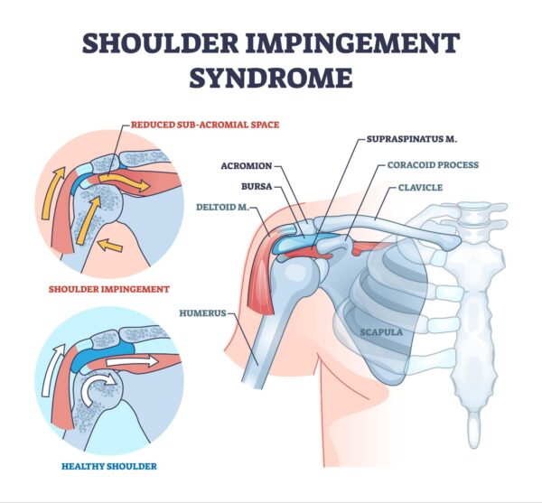 Movement Of The Shoulder Girdle Dictates The Movement Of The Head -  Confident Rider - Mindset, Movement & Nervous System Regulation for  Equestrians